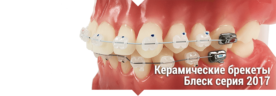 Брекеты керамические "БЛЕСК" РОТ 022 паз, Sm