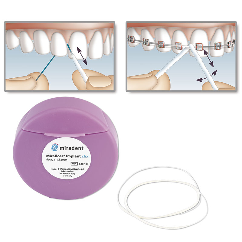 Зубной флосс MIRAFLOSS Implant chx 1,8 мм для имплантов и мостовидных протезов (тонкий), Miradent